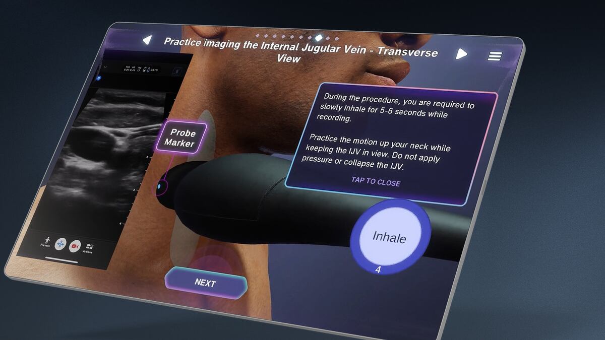 Level Ex ultrasound training tool: practicing imaging the internal jugular vein